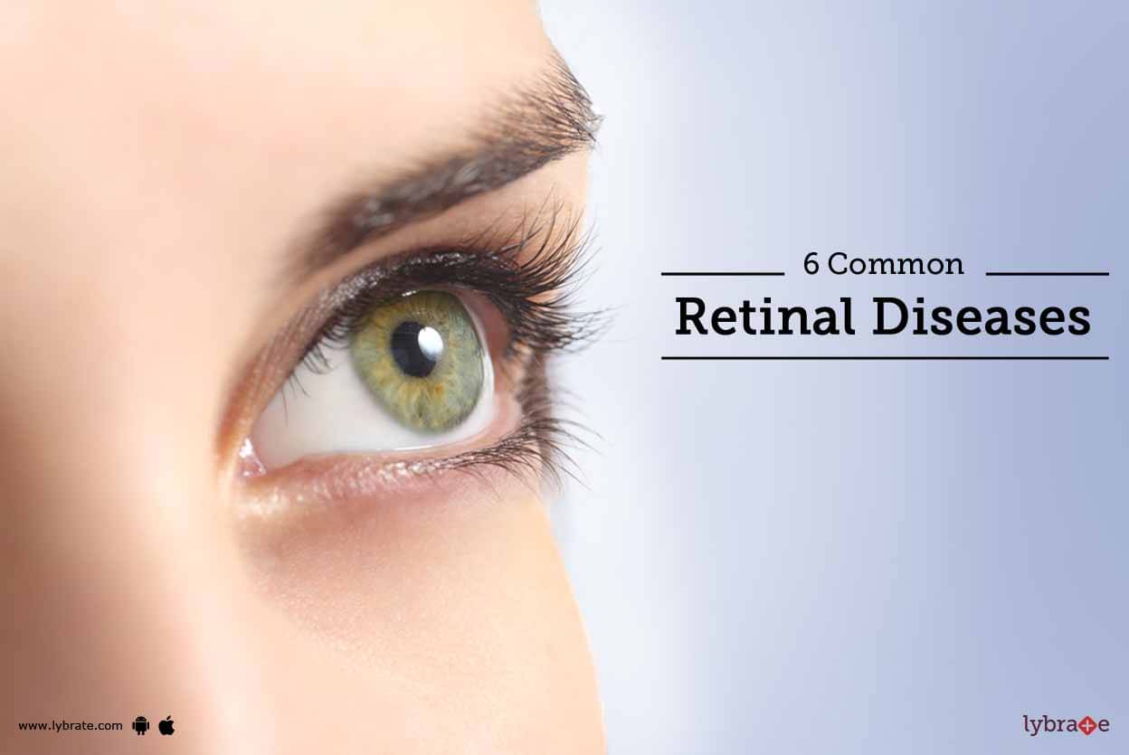 6 Common Retinal Diseases By Dr Tejas D Shah Lybrate