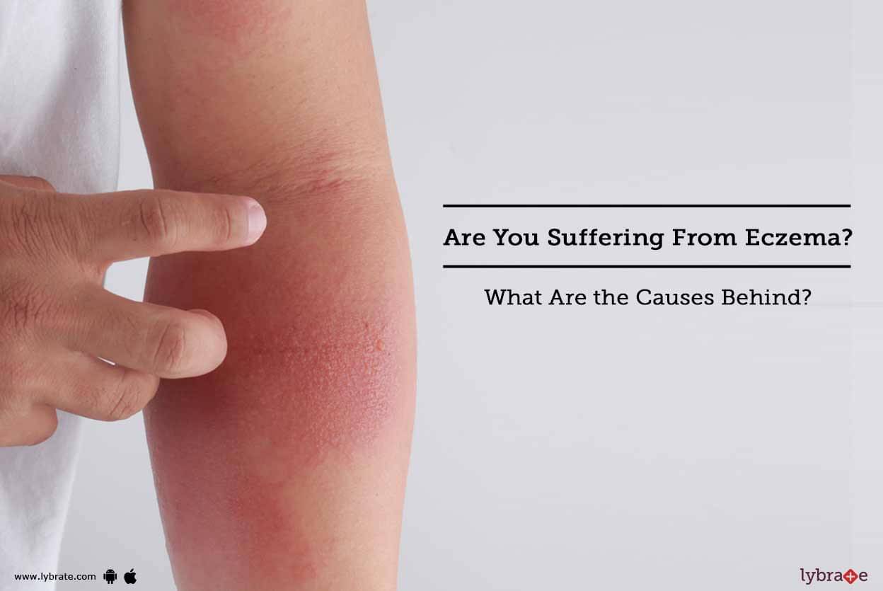 Are You Suffering From Eczema What Are The Causes Behind It By Dr Himanshu Singhal Lybrate