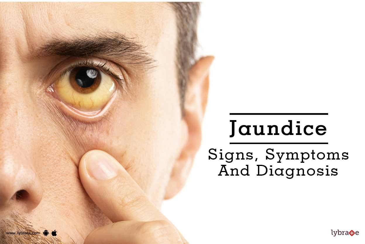 Jaundice Signs Symptoms And Diagnosis By Dr Utsav Nandwana Lybrate