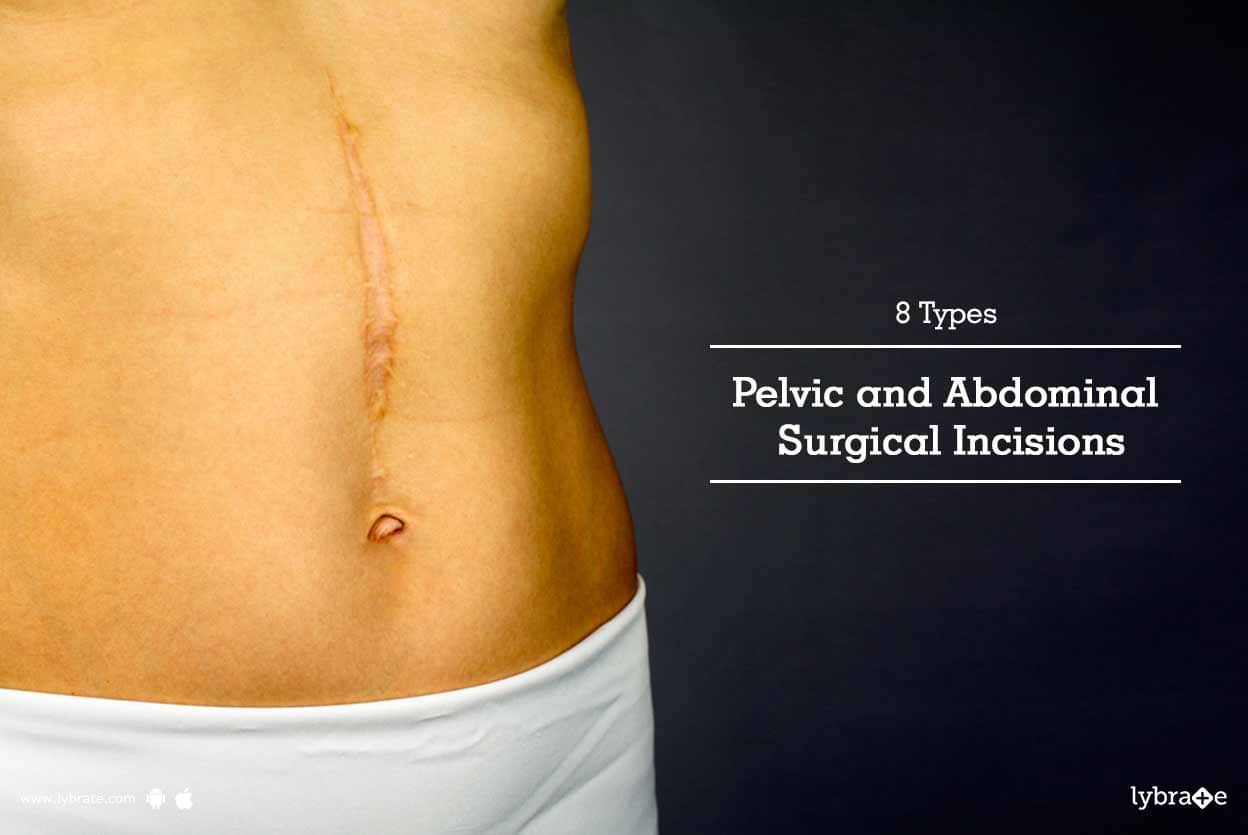 Abdominal Surgical Incisions Types