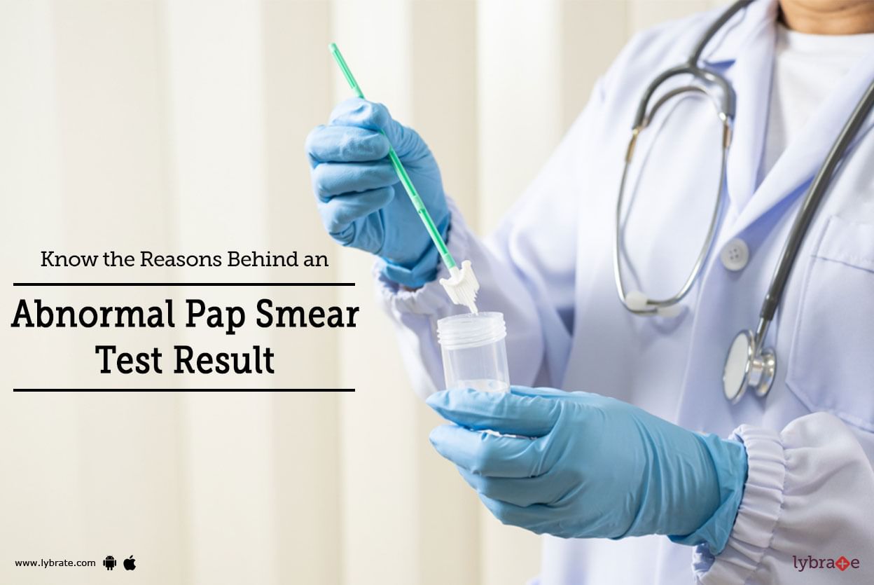 Know The Reasons Behind An Abnormal Pap Smear Test Result By Dr