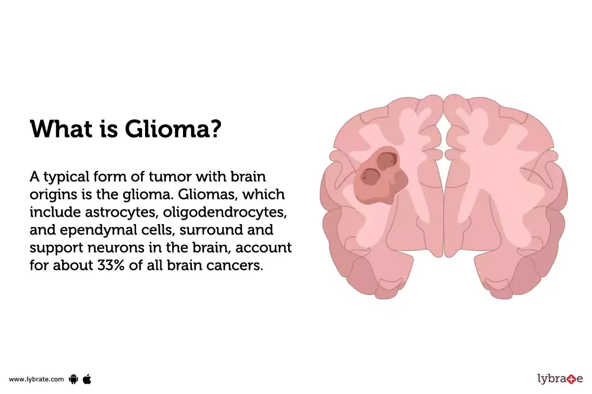 Glioma Treatment Procedure Cost Recovery Side Effects And More