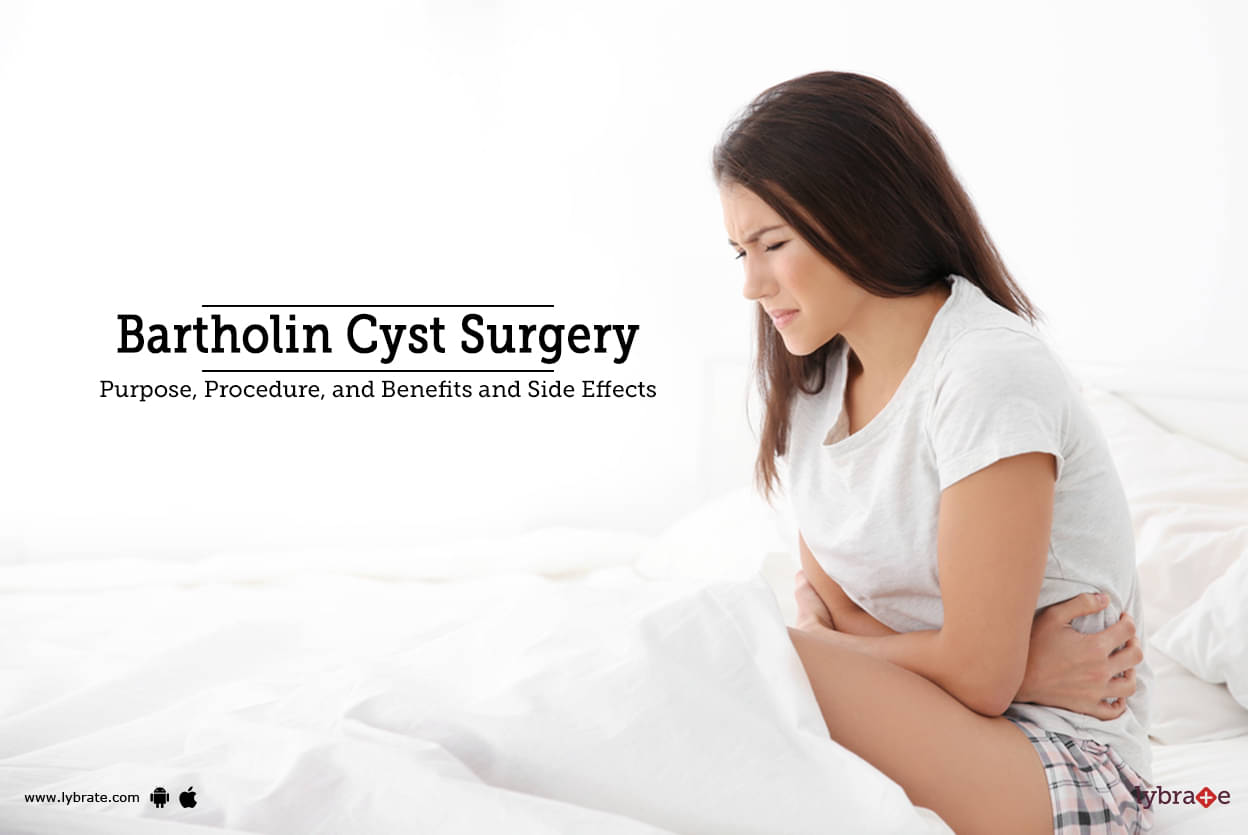 Bartholin Cyst Surgery Purpose Procedure Benefits And Side Effects