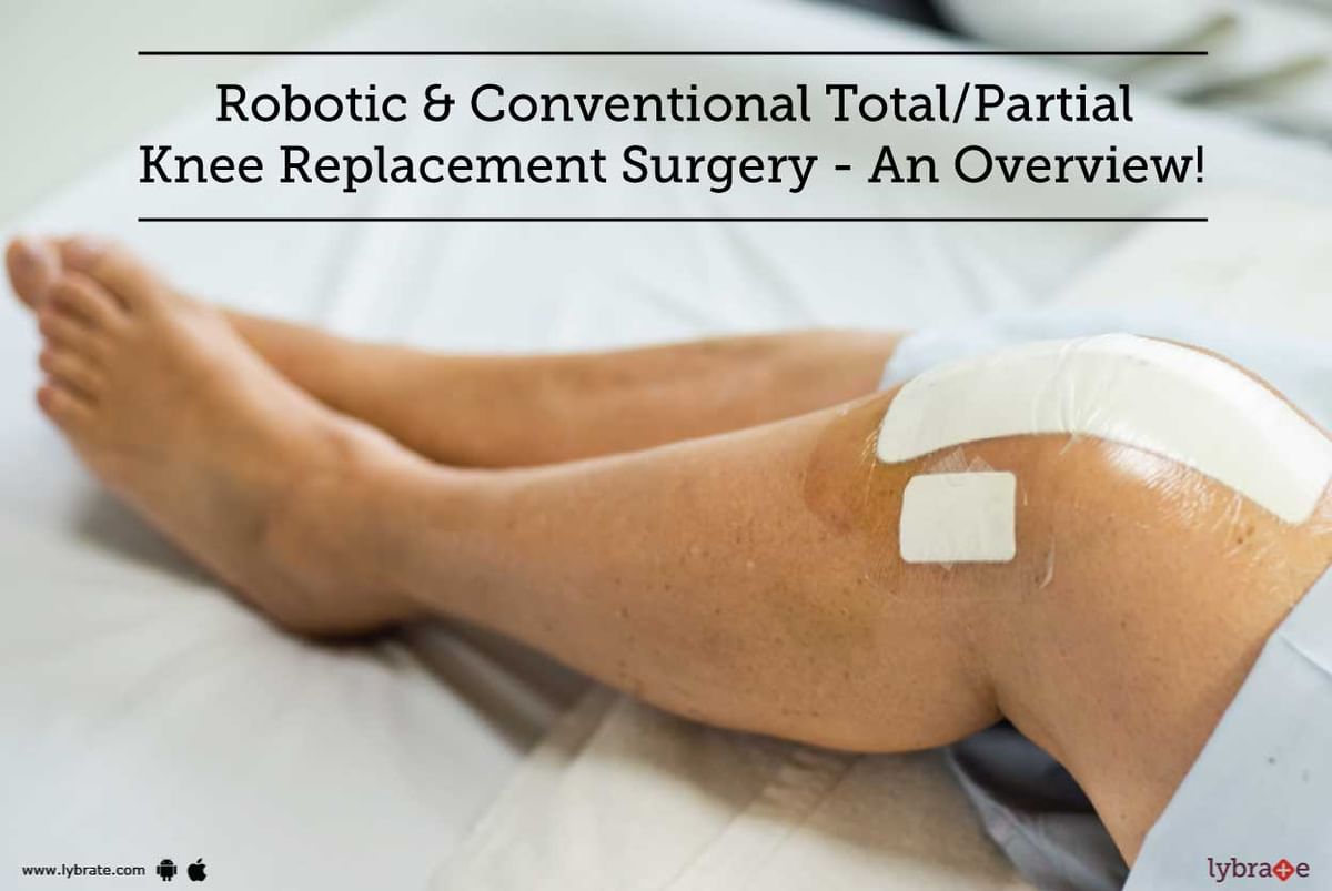 Robotic Conventional Total Partial Knee Replacement Surgery An