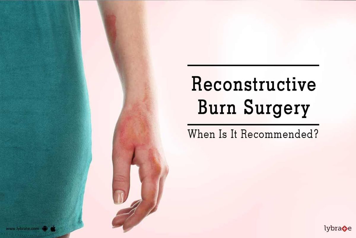 Reconstructive Burn Surgery When Is It Recommended By Dr Purnima Aiyer Lybrate