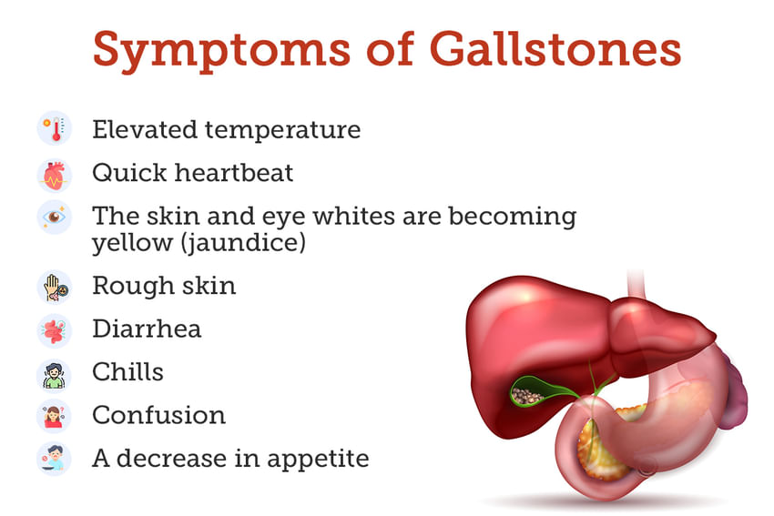 Gallstones Treatment Procedure Cost Recovery Side Effects And More