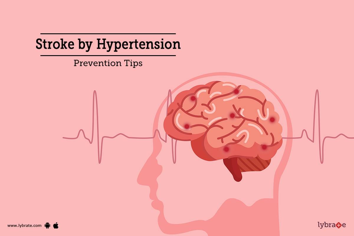 stroke-by-hypertension-prevention-tips-by-dr-garima-lybrate