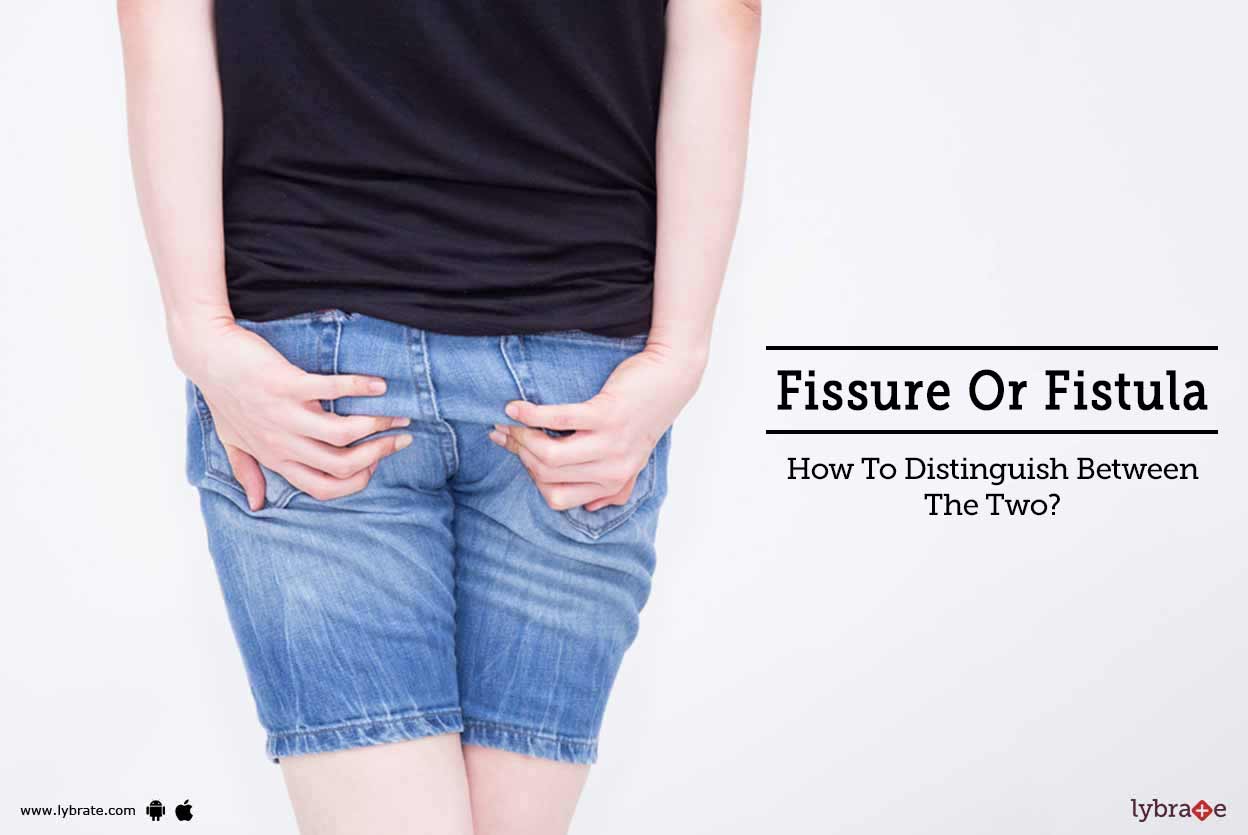 Fissure Or Fistula How To Distinguish Between The Two? By Ab