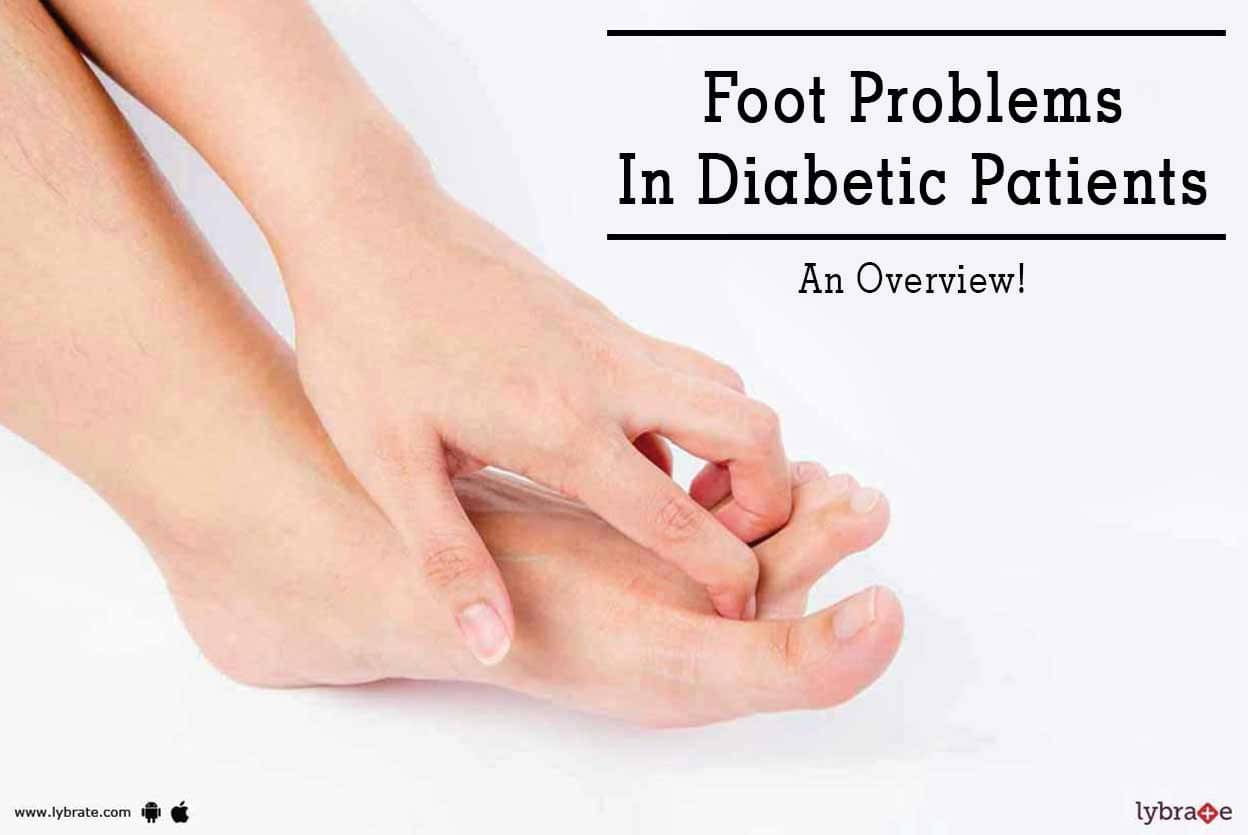 Foot Problems In Diabetic Patients - An Overview! - By Dr. Milind Ruke ...