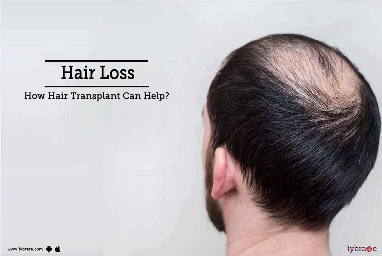 Hair Loss How Hair Transplant Can Help By Dr Ramneek Kaur Lybrate