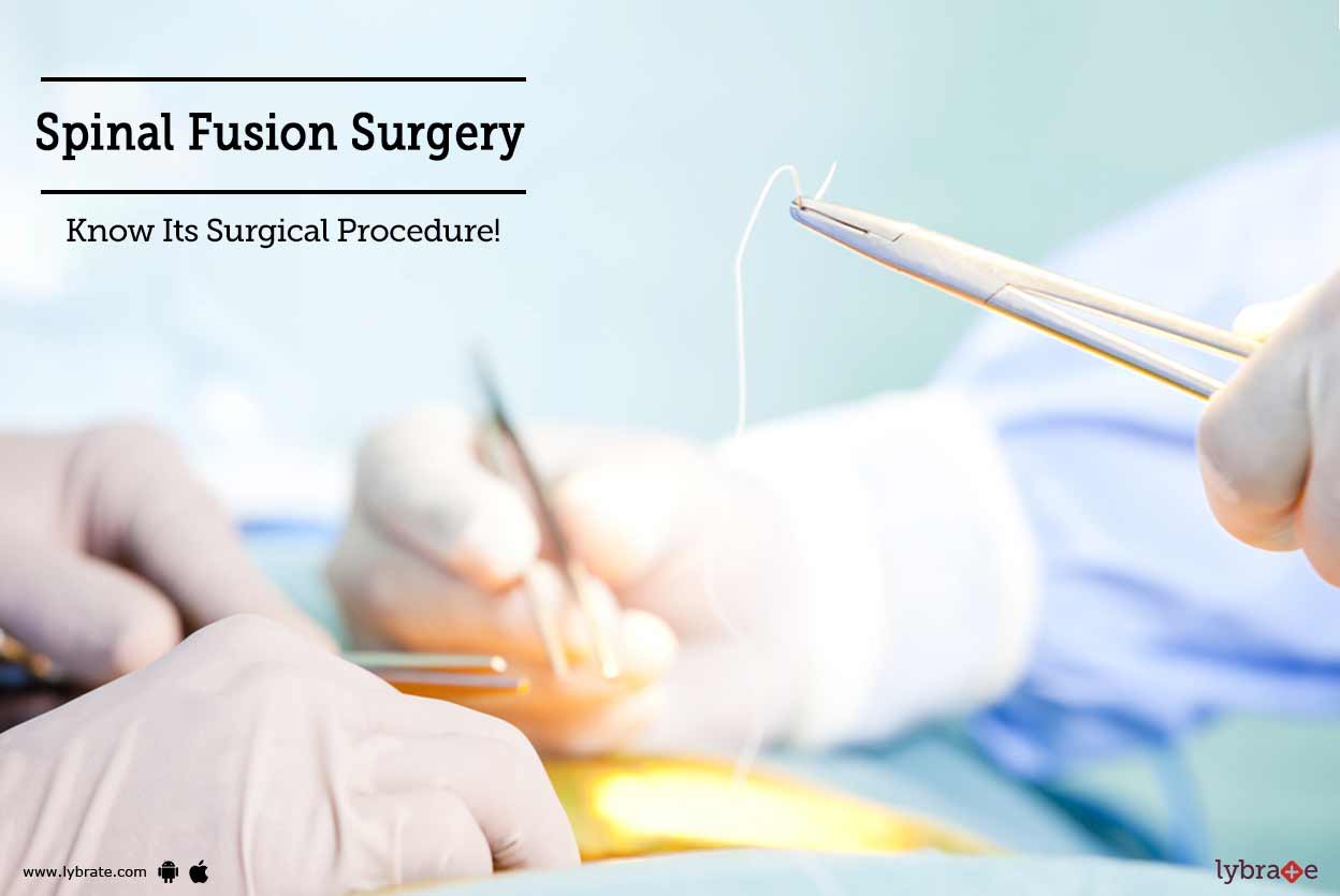 Spinal Fusion Surgery - Know Its Surgical Procedure! - By Dr. Shailesh ...
