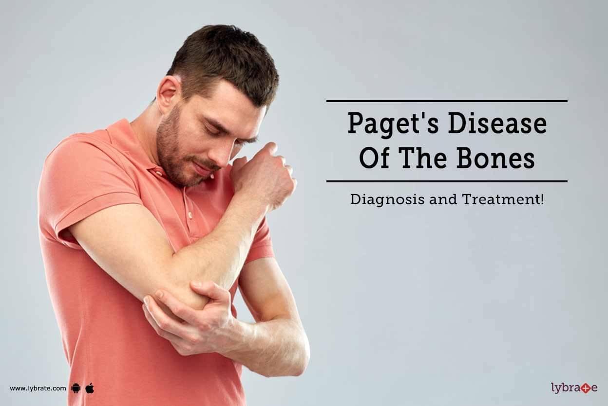 Paget's Disease Of The Bones - Diagnosis and Treatment! - By Dr. Sanjib