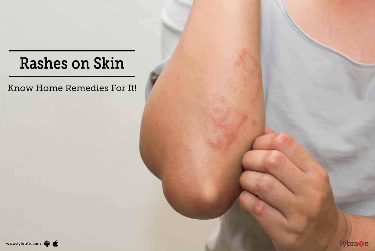 Rashes On Skin Know Home Remedies For It By Dr Ashwini Mohan Lybrate