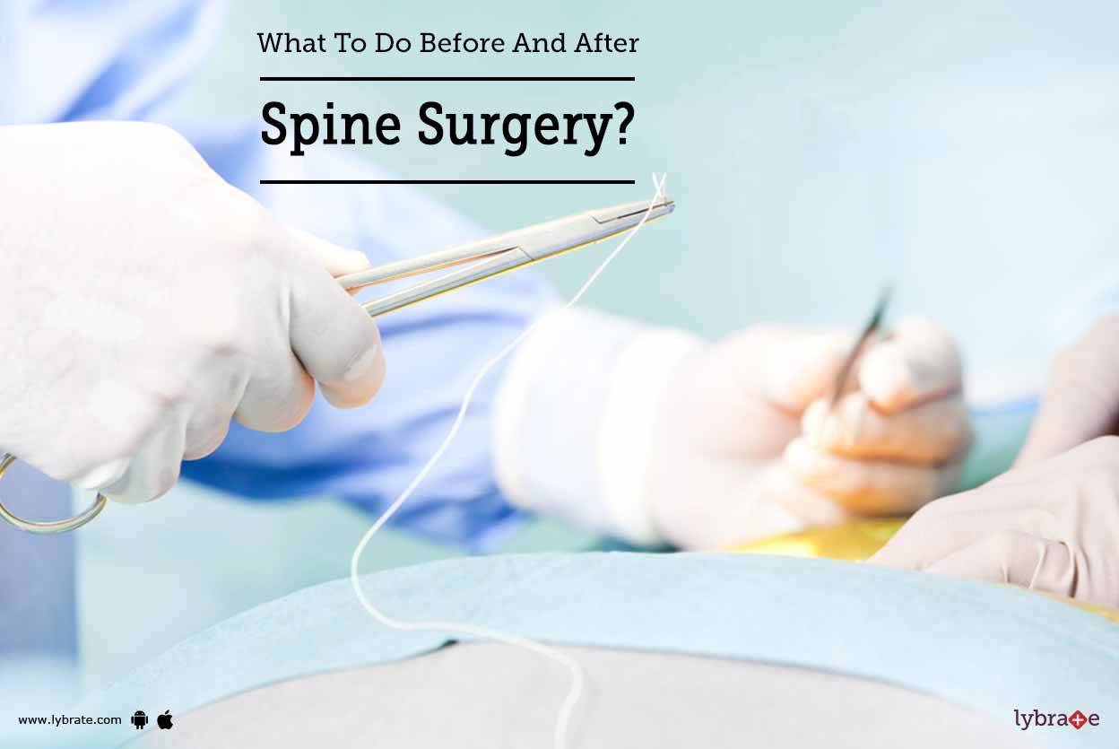 What To Do Before And After Spine Surgery? By Dr. Rakesh Kumar Lybrate