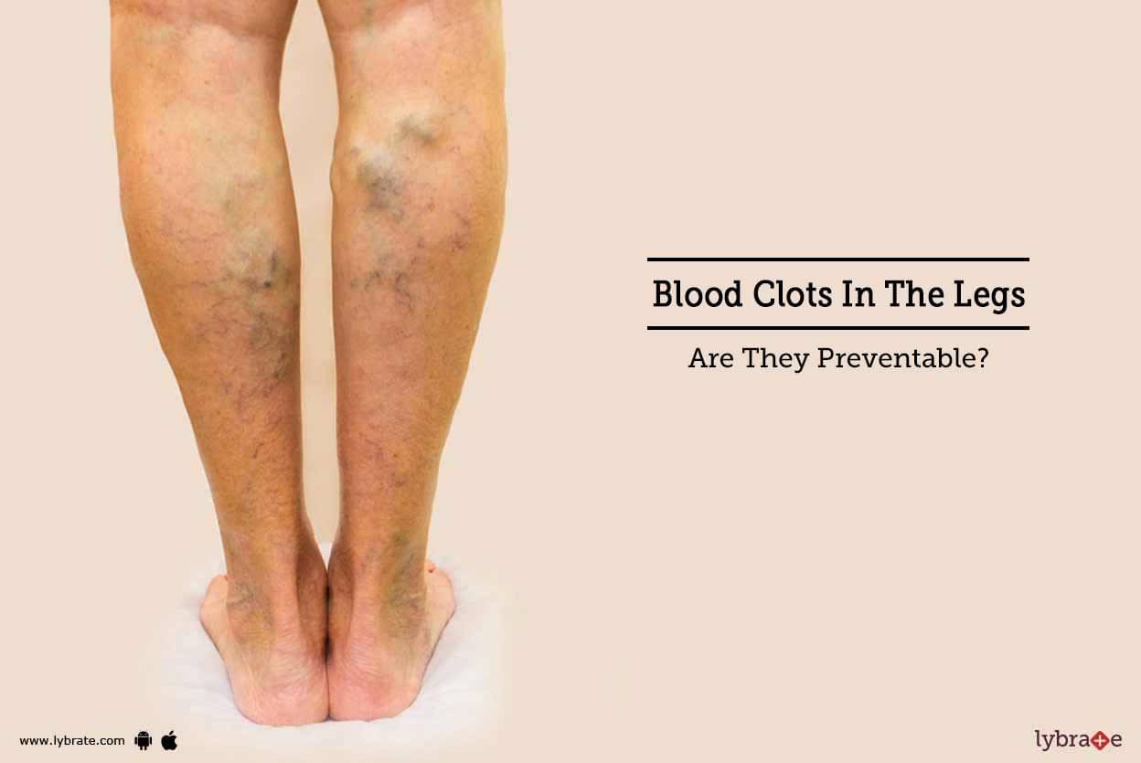 Symptoms Of Blood Clot In Thigh Leg Blood Clot In Leg Signs Images