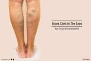 What Do Blood Clots Feel Like In Leg At Juan Mcqueen Blog