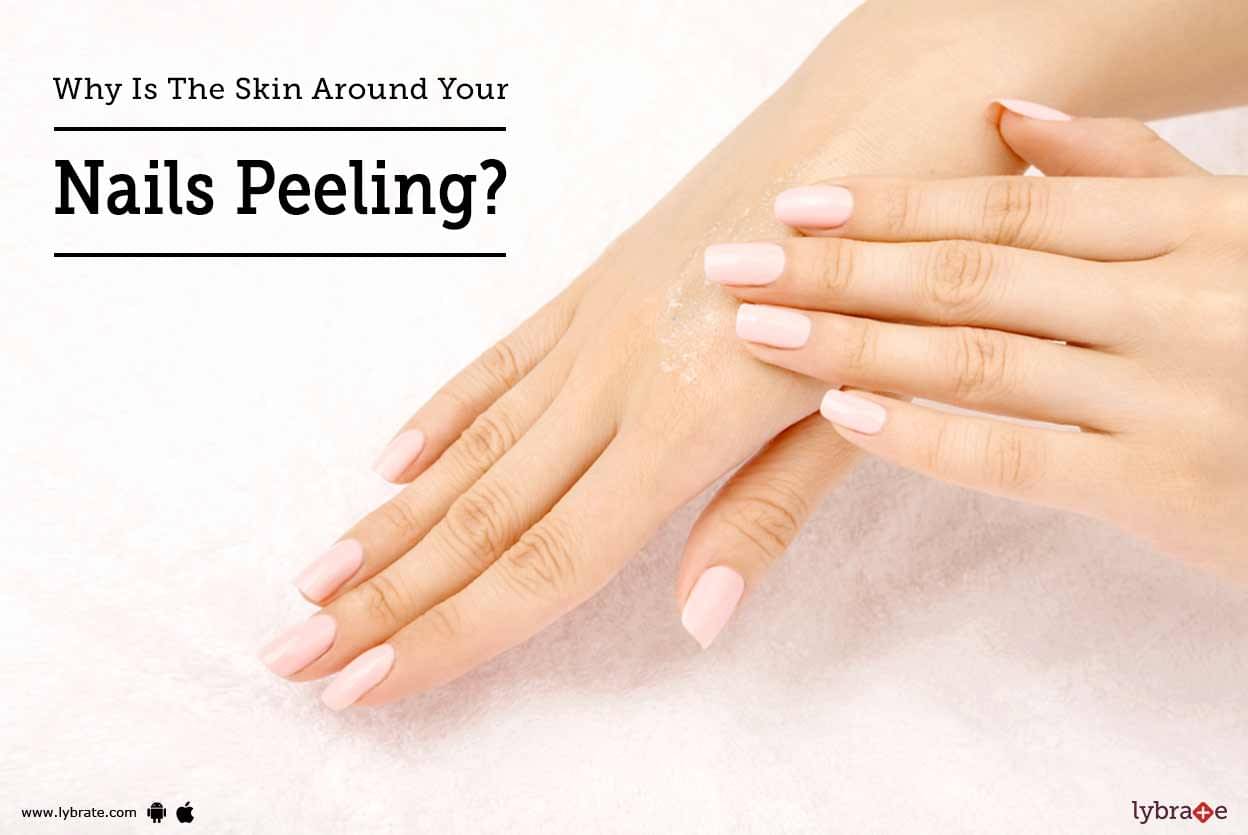 Why Is The Skin Around Your Nails Peeling By Dr Lakshmi Manasi Lybrate