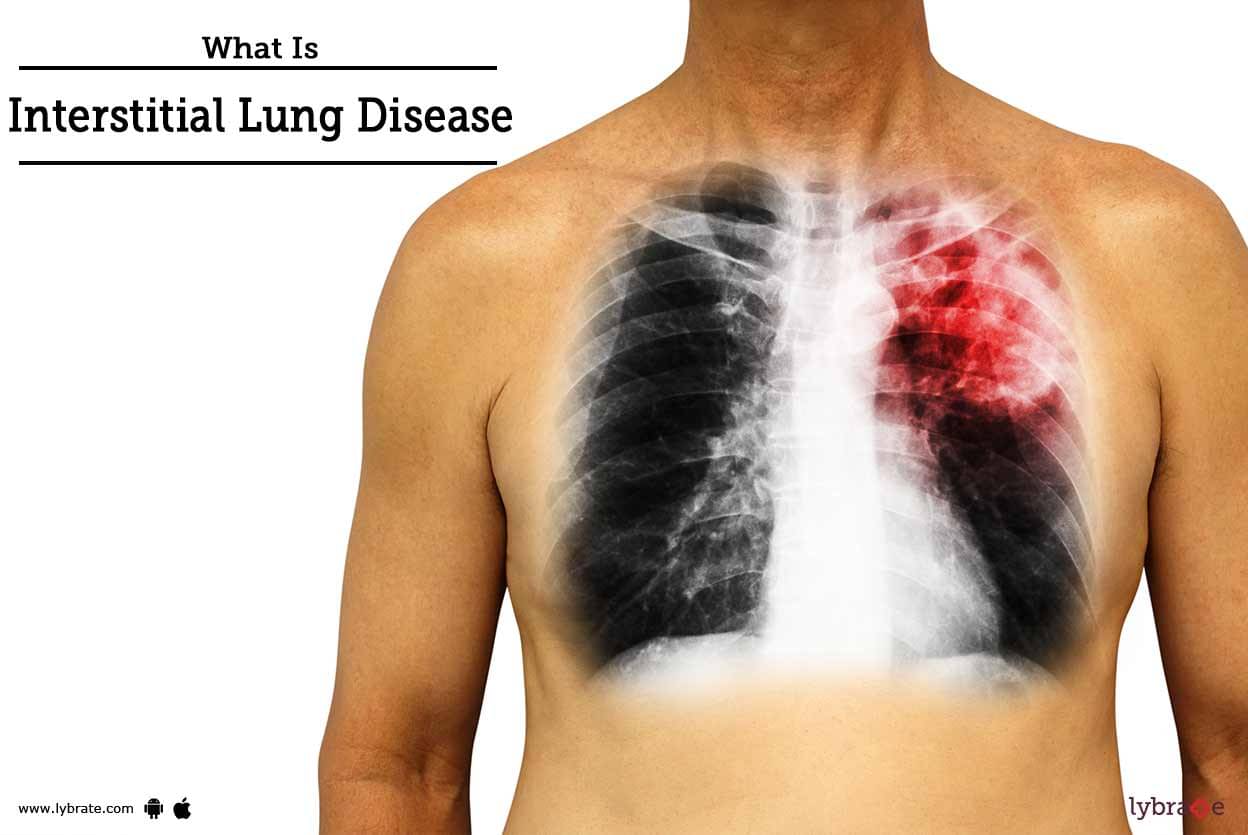 Is Dying From Lung Disease Painful