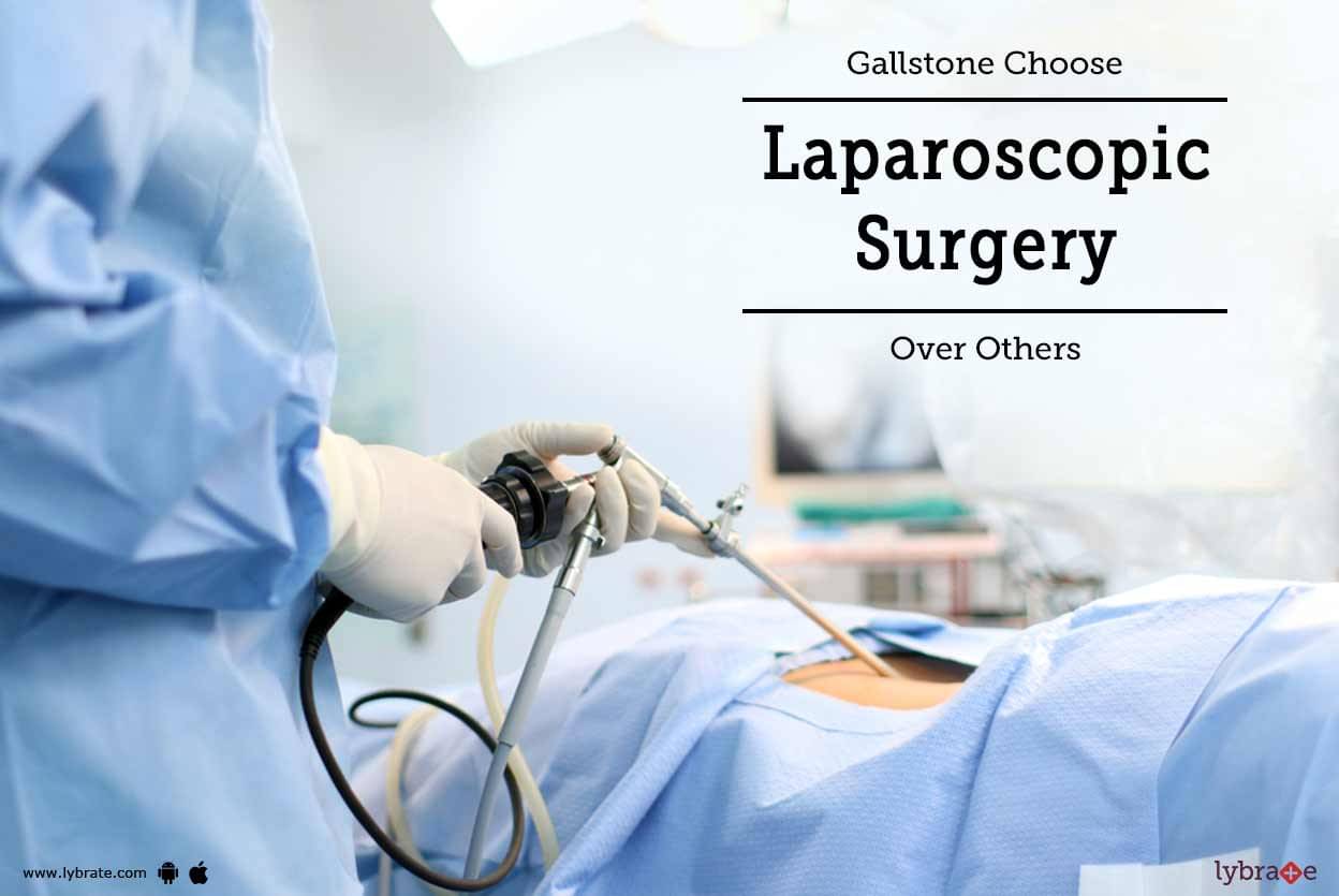 Gallstone: Choose Laparoscopic Surgery Over Others - By Dr. Rahul Sinha ...