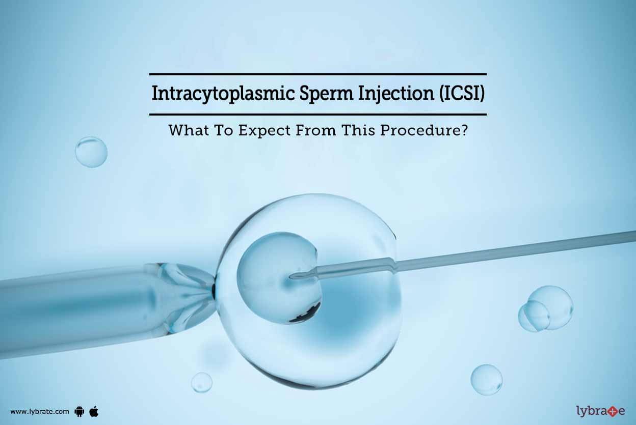 Intracytoplasmic Sperm Injection (icsi) - What To Expect From This 