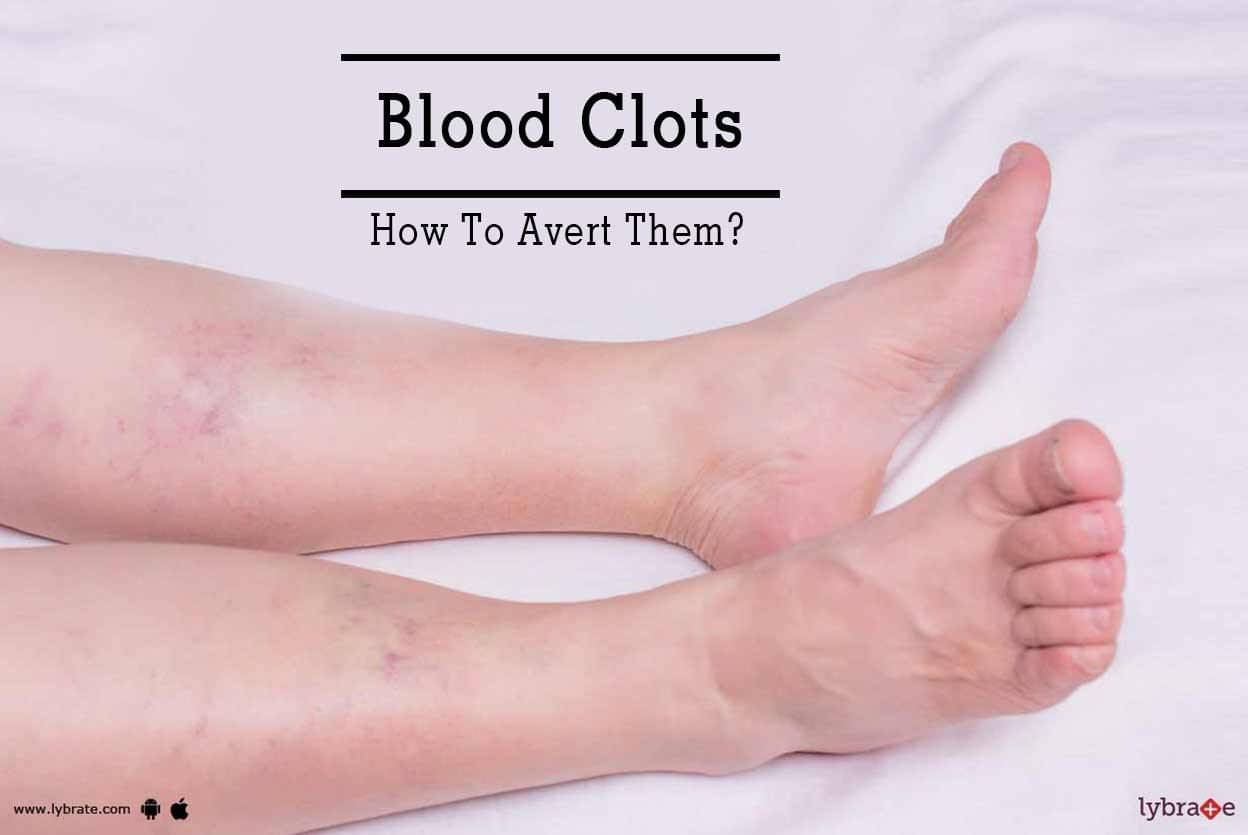 Blood Clots - How To Avert Them? - By Dr. M.S. Rani | Lybrate