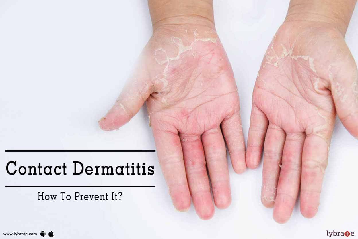 Contact Dermatitis - How To Prevent It? - By Dr. Navnit Haror 