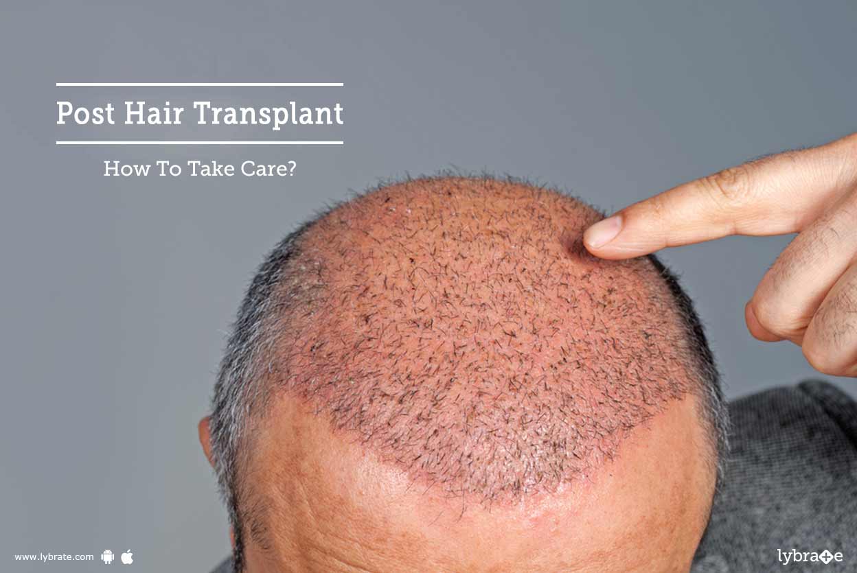 Post Hair Transplant How To Take Care By Cosmetica Skin Laser