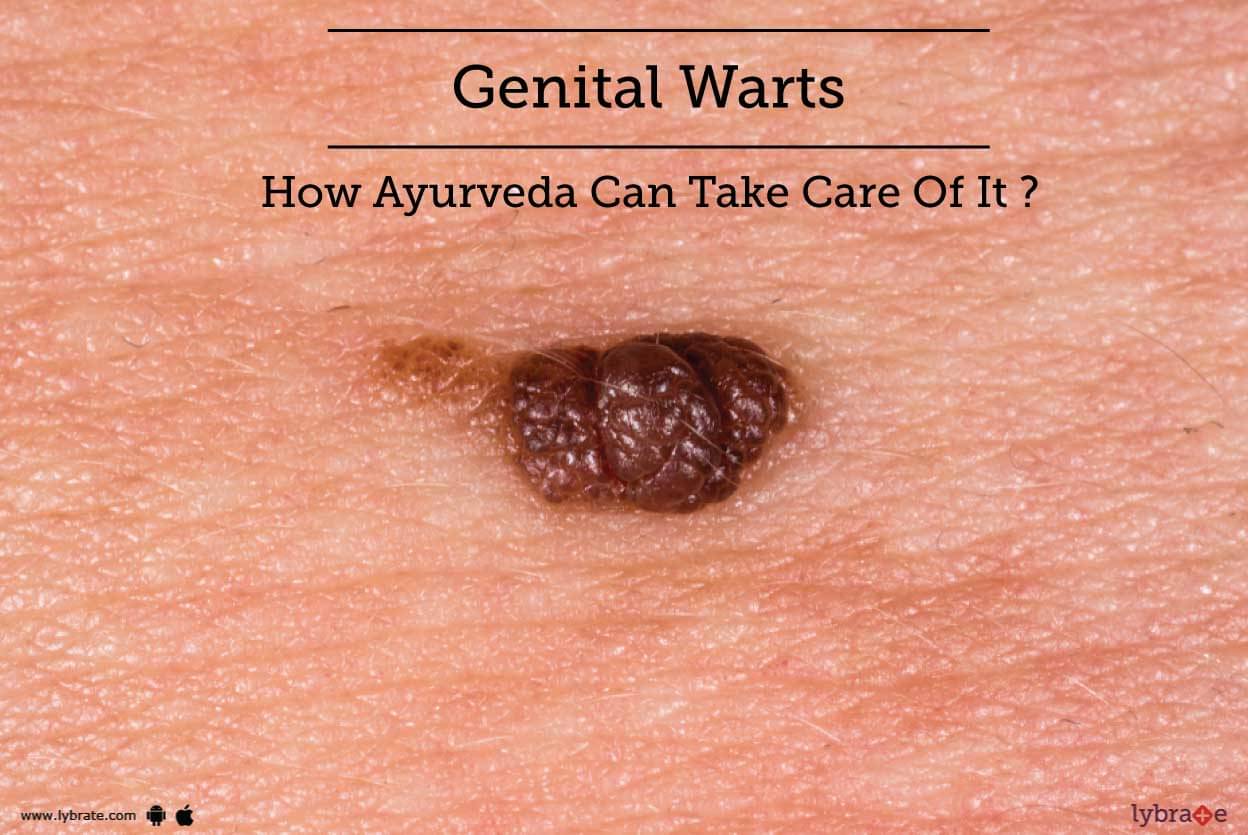 Genital Warts How Ayurveda Can Take Care Of It By Dr G S Lavekar Lybrate 