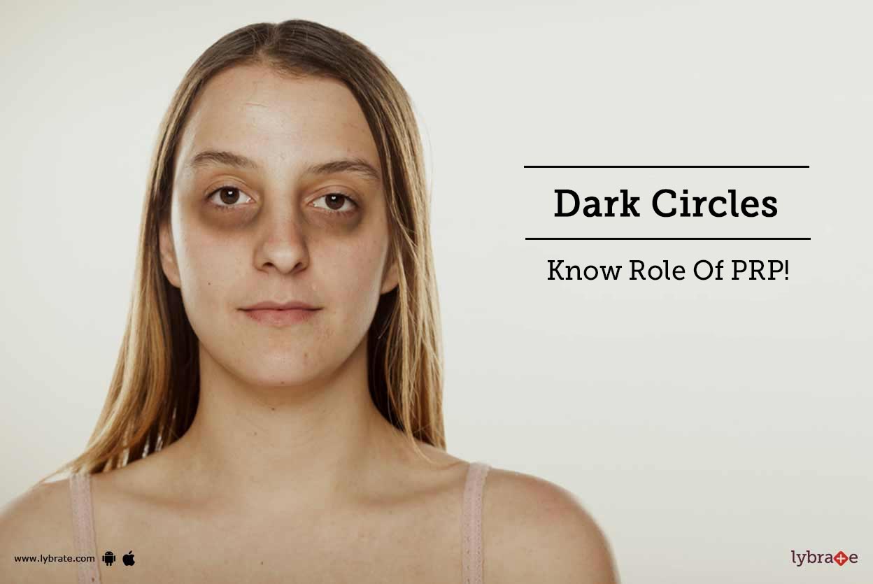 plasma dark eye circles