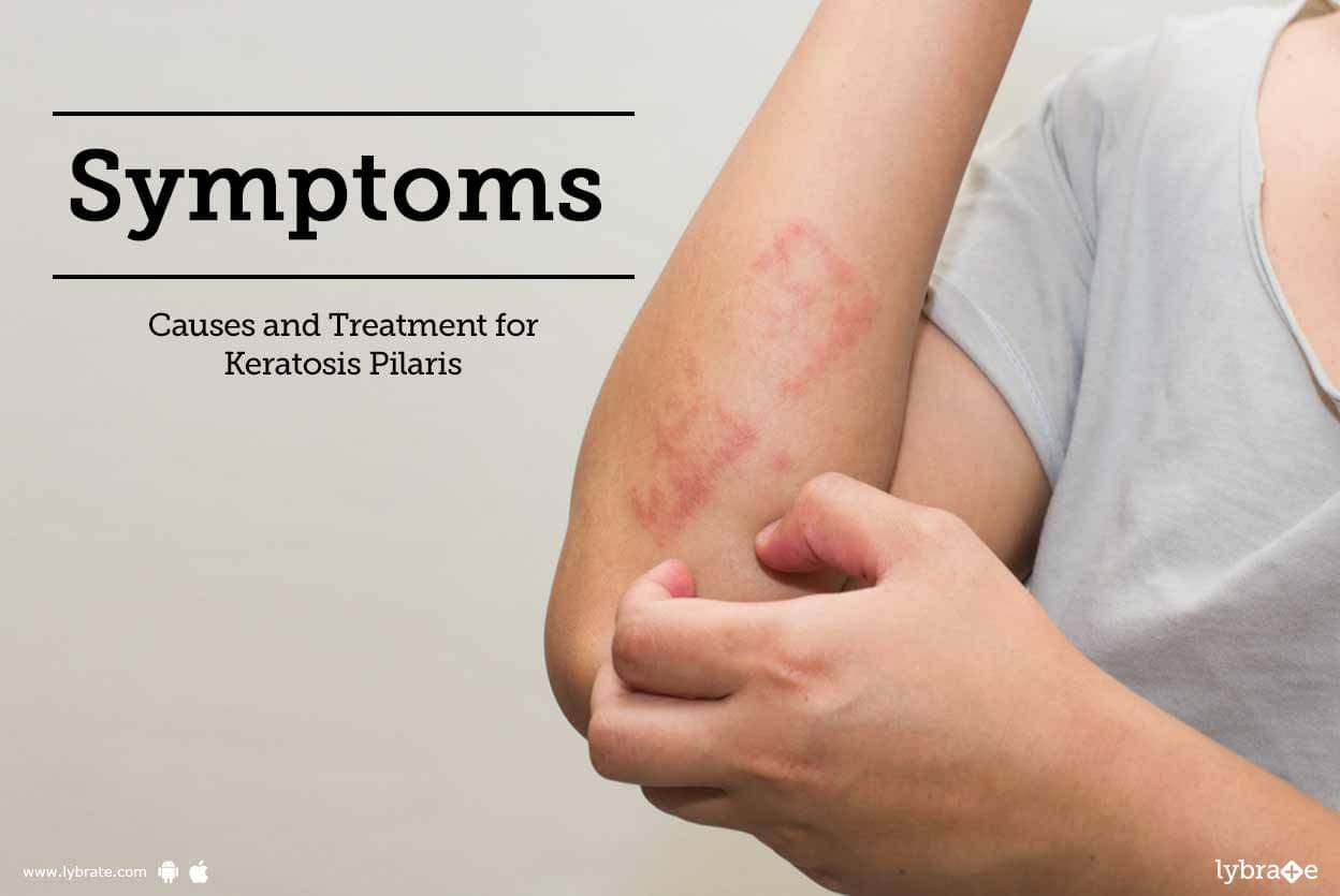 Symptoms Causes And Treatment For Keratosis Pilaris By Kaya Skin Clinic Lybrate