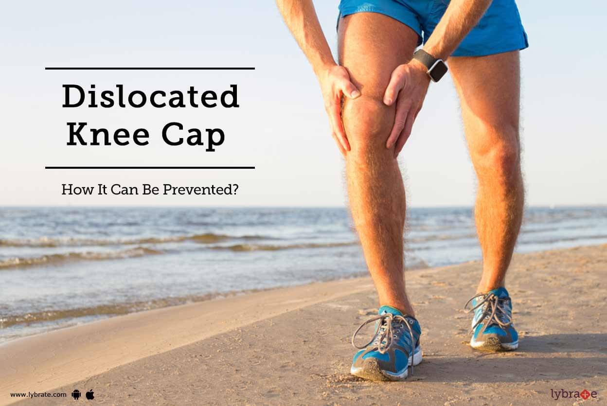 therapy for dislocated kneecap