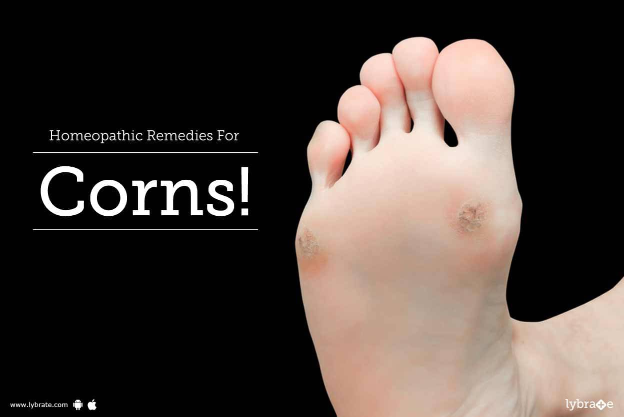 homeopathic medicine for foot corn