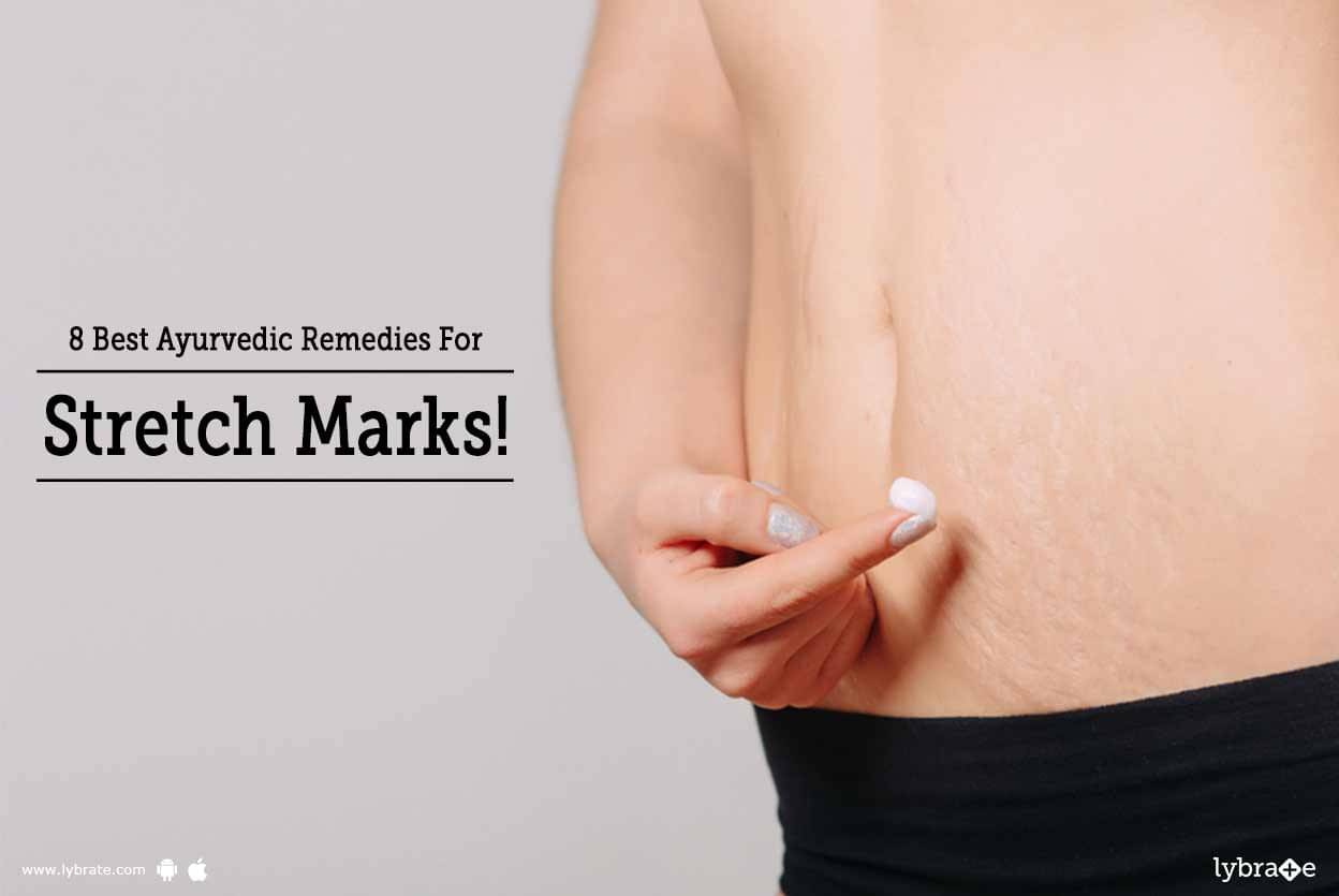 8 Best Ayurvedic Remedies For Stretch Marks By Dr Sudarshan K Achar Lybrate