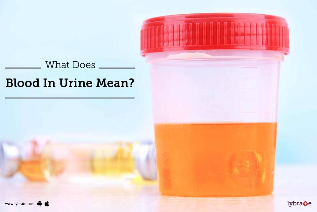 tinge of blood in urine