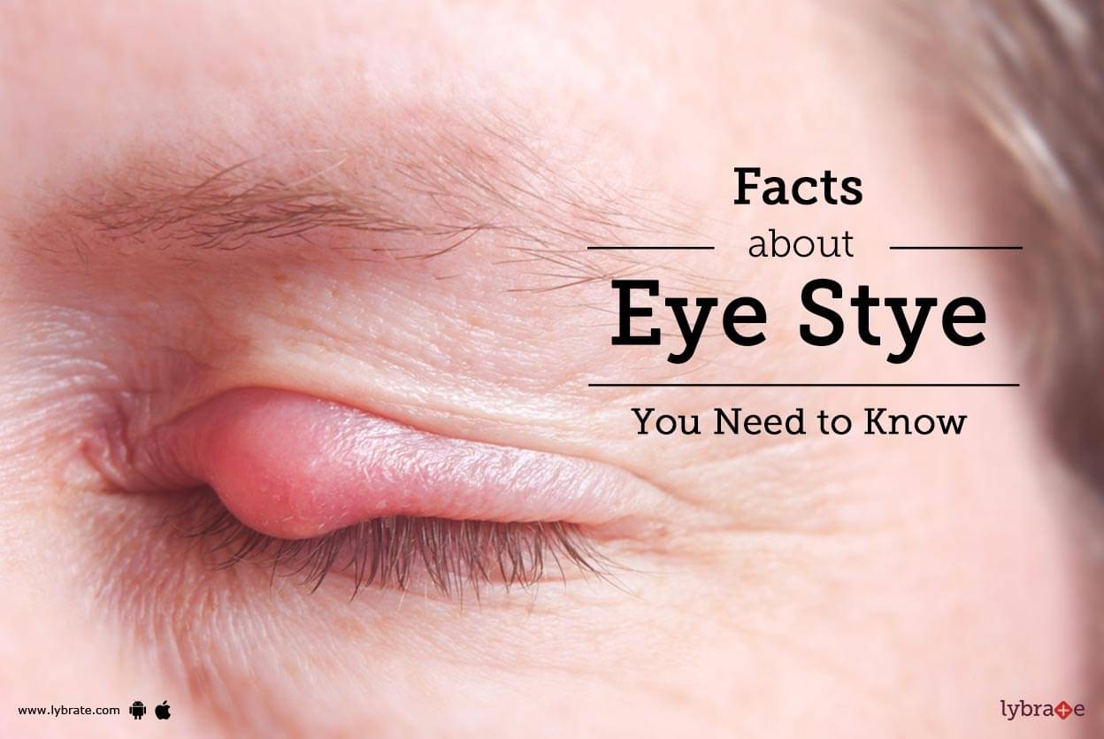 Facts About Eye Stye You Need to Know - By Isaac 