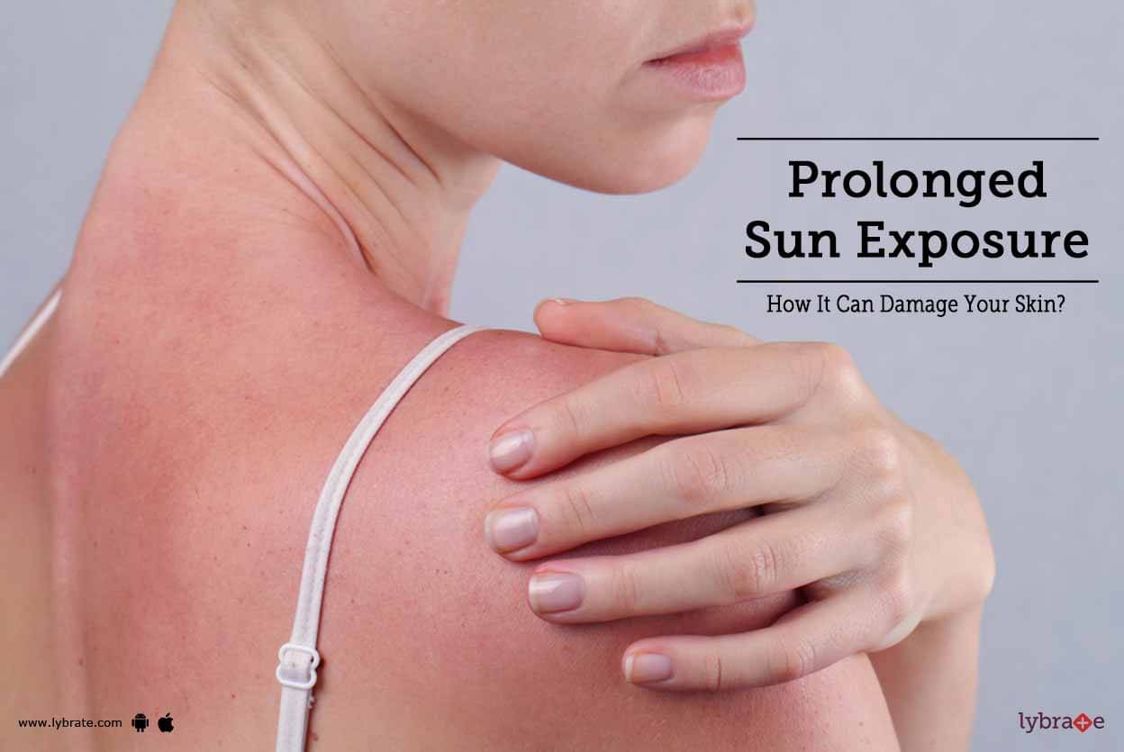 prolonged-sun-exposure-how-it-can-damage-your-skin-by-dr