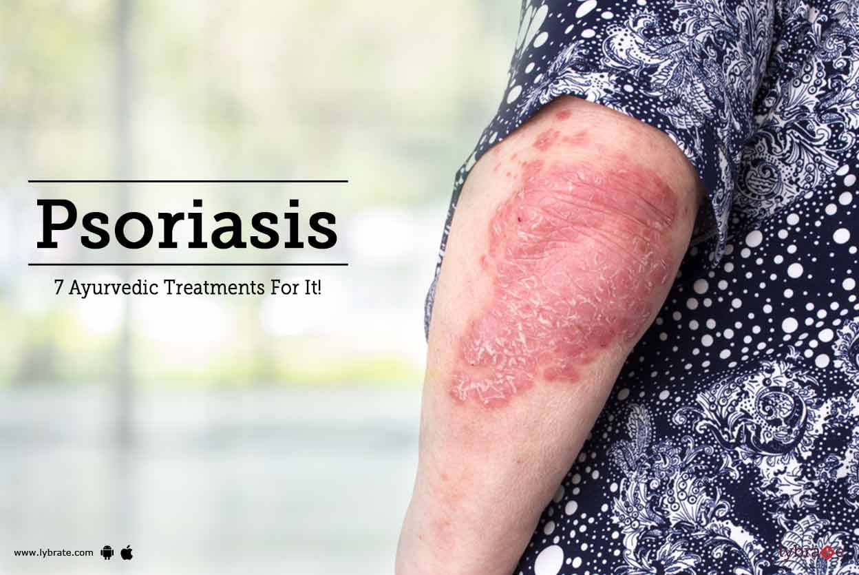 psoriasis disease symptoms in hindi)