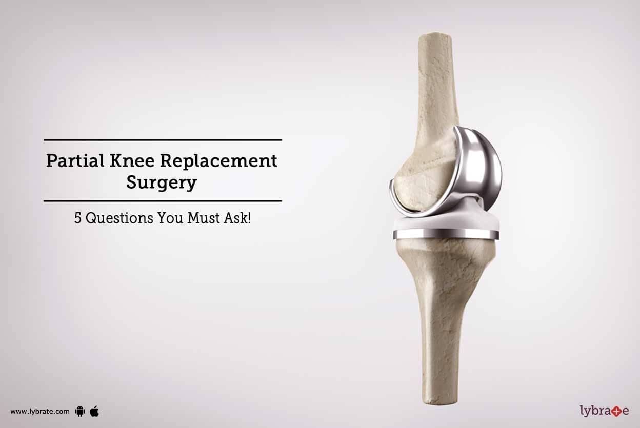 Can You Run After Partial Knee Replacement