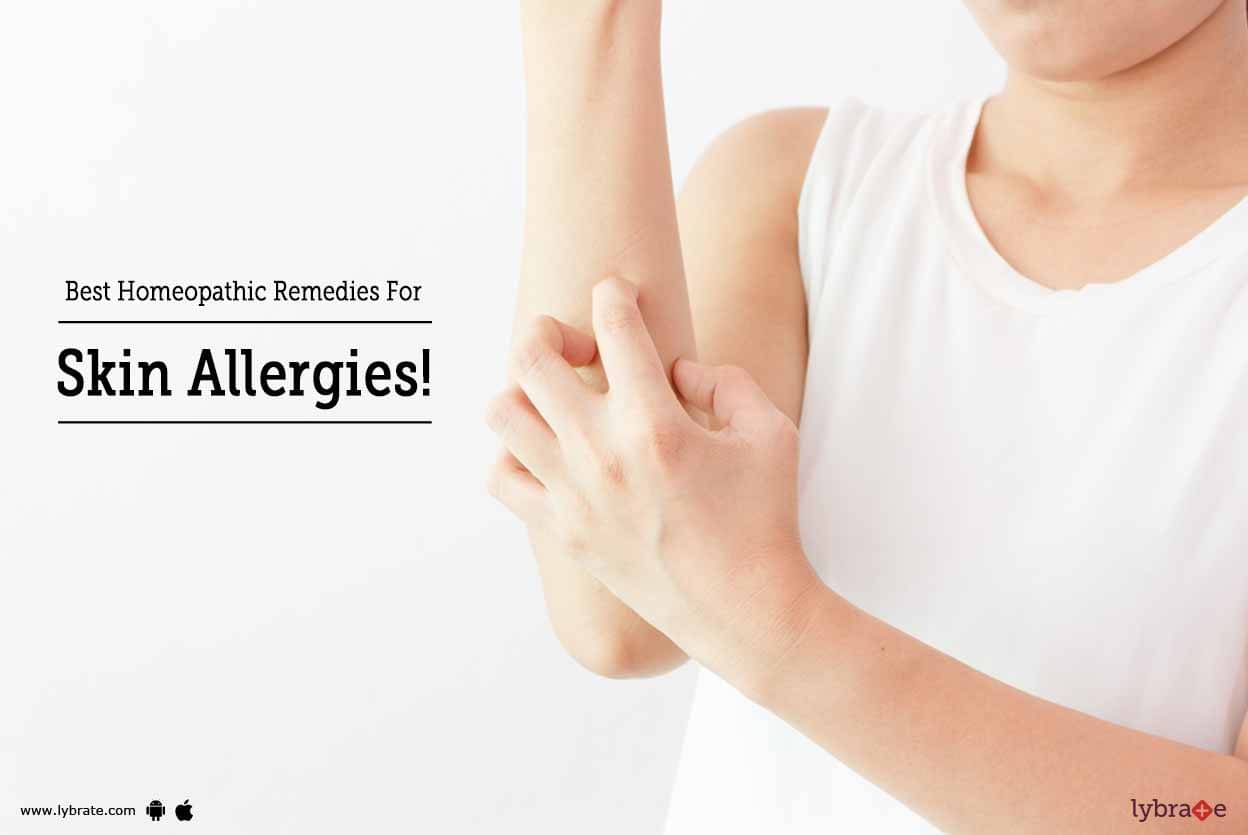 best-homeopathic-remedies-for-skin-allergies-by-dr-chetan-raj-lybrate