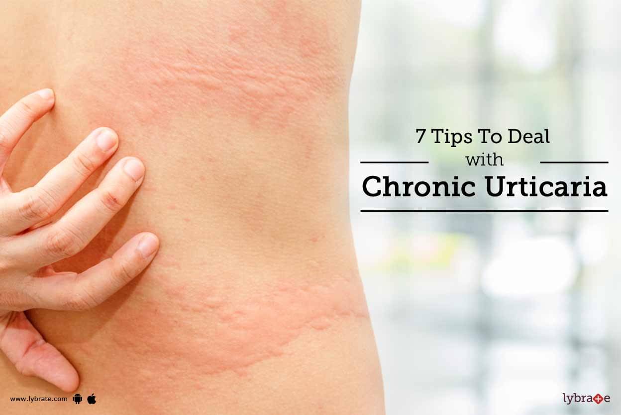 7 Tips To Get Rid Of Chronic Urticaria Or Hives By Dr Deepti Shrivastava Lybrate 