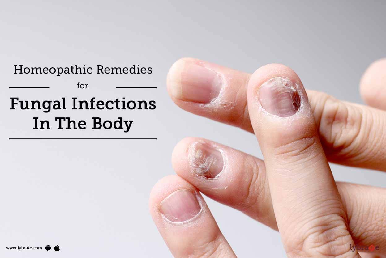 homeopathic-remedies-for-fungal-infections-in-the-body-by-dr