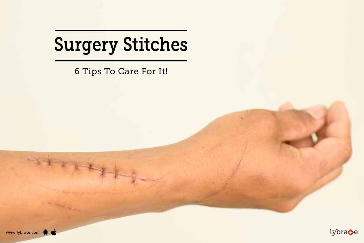 Surgery Stitches - 6 Tips To Care For It! - By Dr. Tarun Agarwal | Lybrate