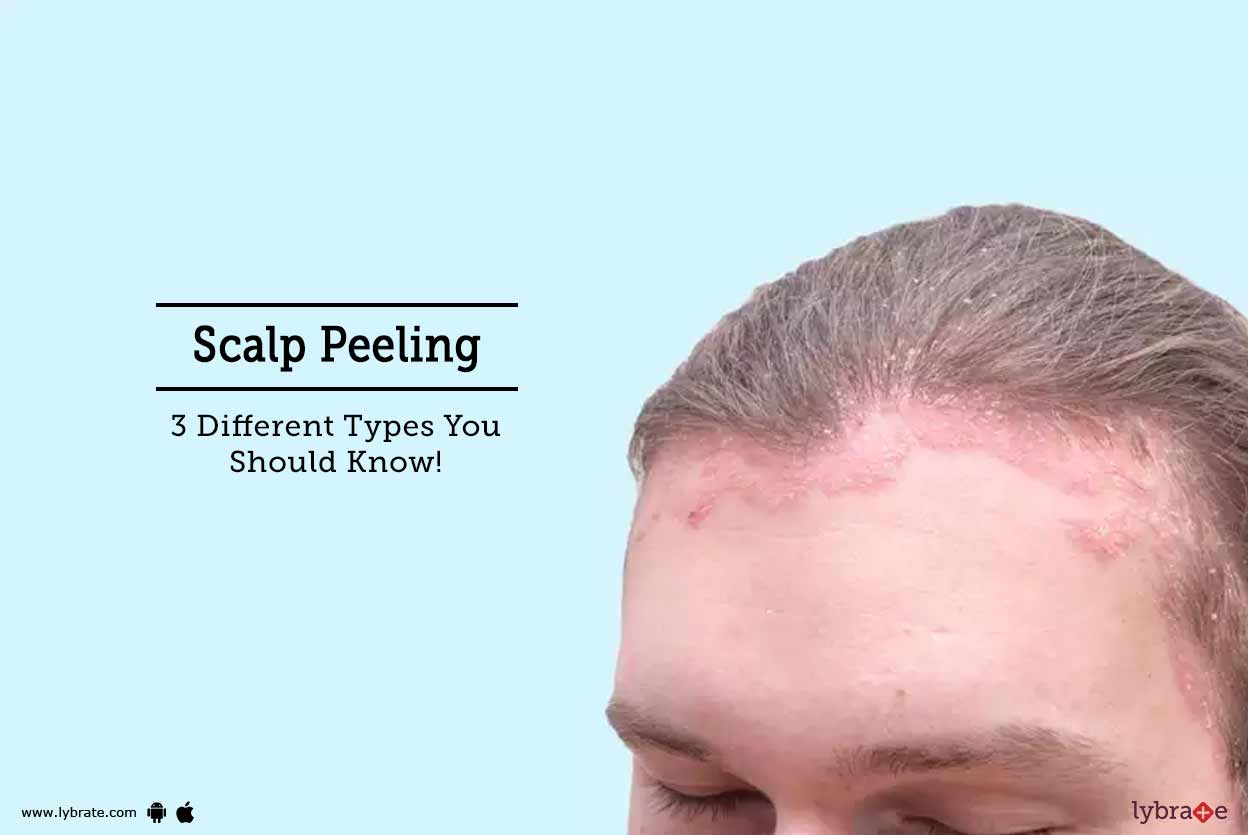 Scalp Peeling 3 Different Types You Should Know! By Dr. Dinesh
