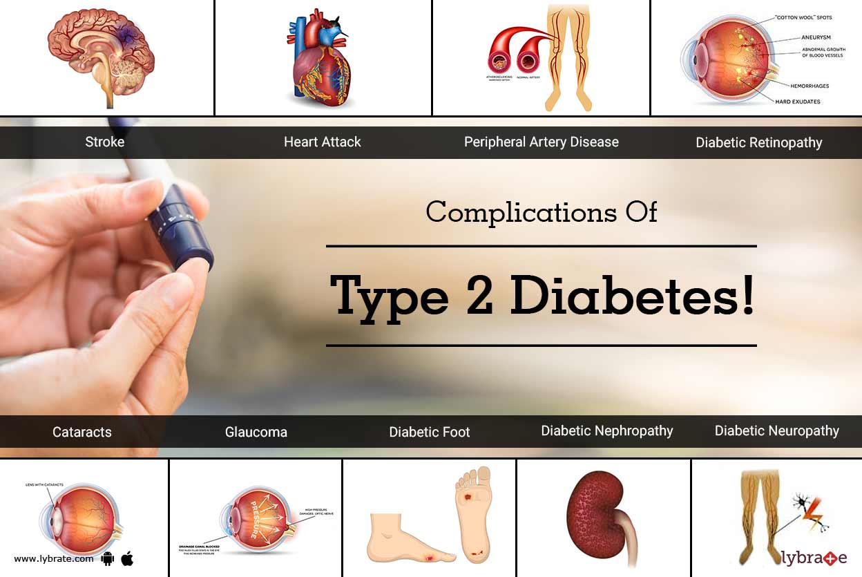 Complications of type 2 diabetes by dr rameez athar falke lybrate
