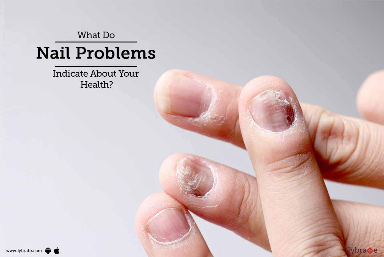 What Do Nail Problems Indicate About Your Health By Dr Krishnarajsingh Thakur Lybrate