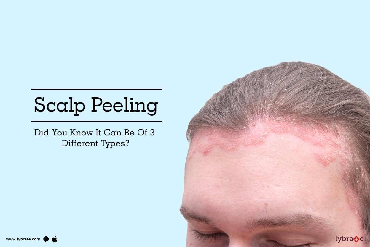 scalp peeling skin types different hair lybrate aesthetic