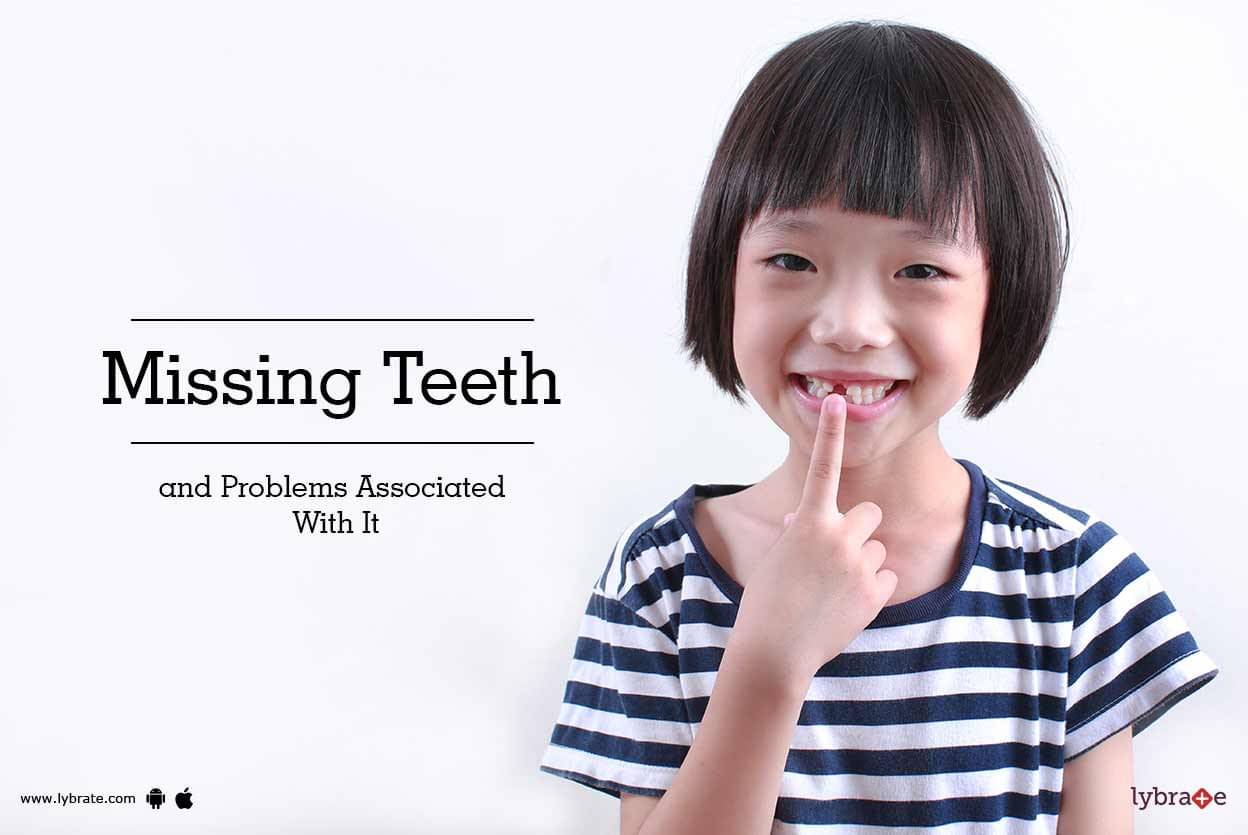 Missing Teeth And Problems Associated With It - By Dr. Aman Ahuja | Lybrate