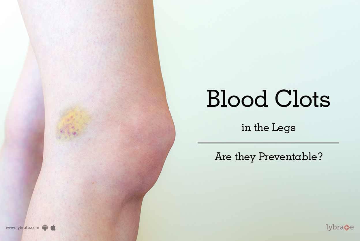 how-to-prevent-blood-clots-in-the-legs-natural-ways-by-dr-murali