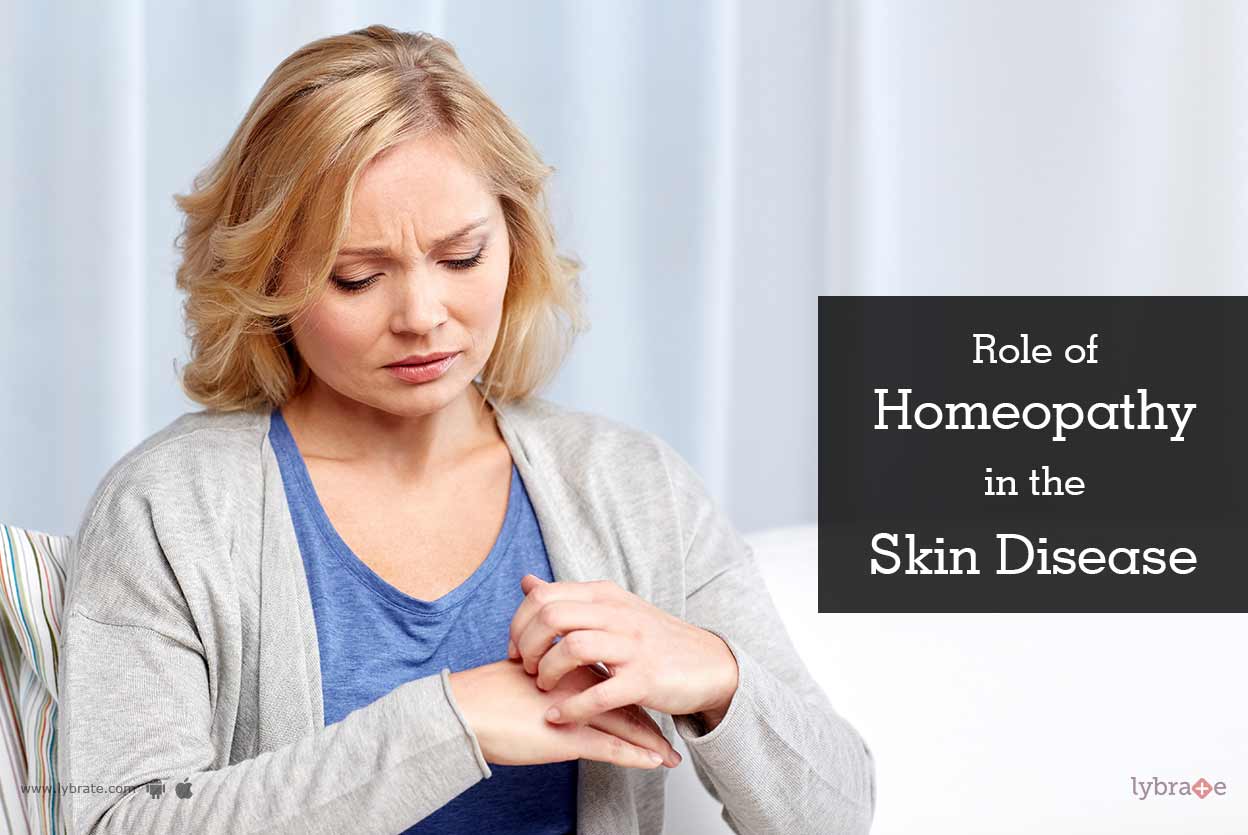 Role Of Homeopathy In The Skin Disease By Dr. Pramod Sharma Lybrate