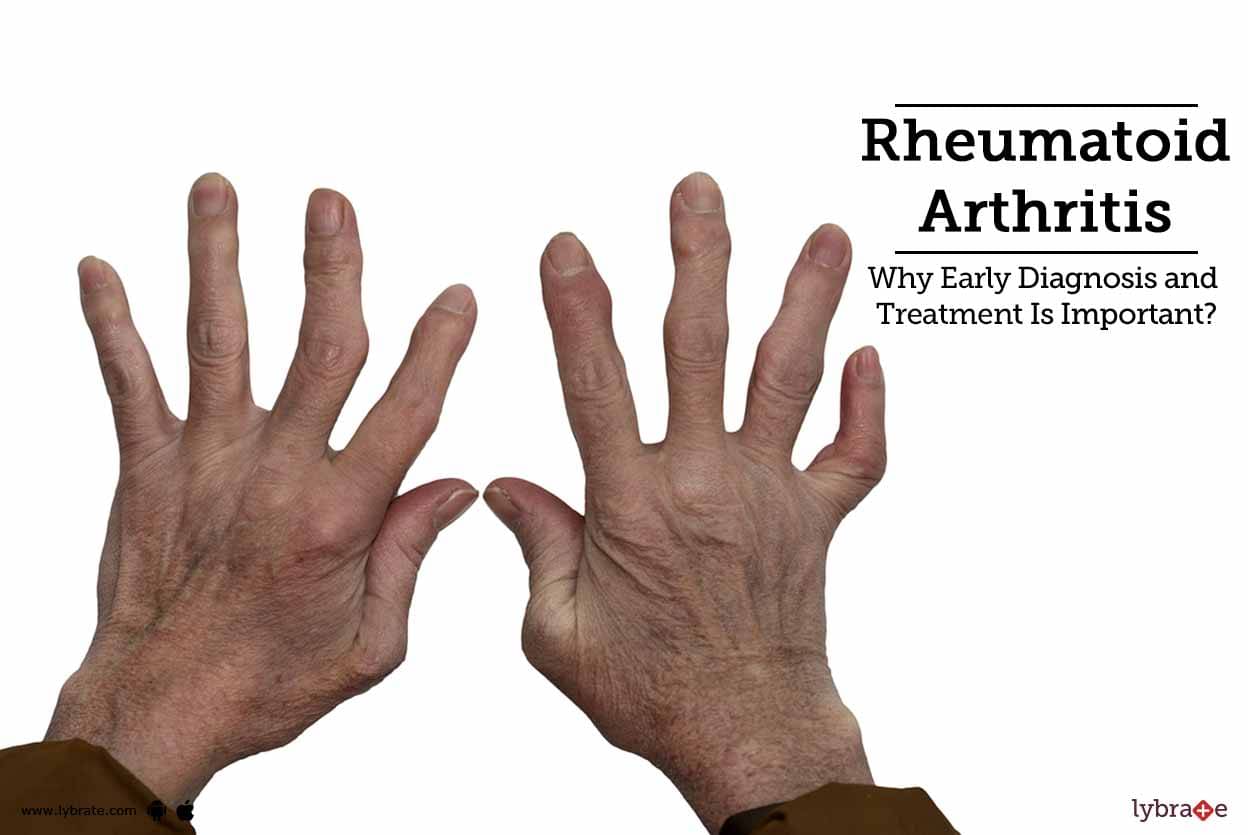 Rheumatoid Arthritis Why Early Diagnosis and Treatment Is